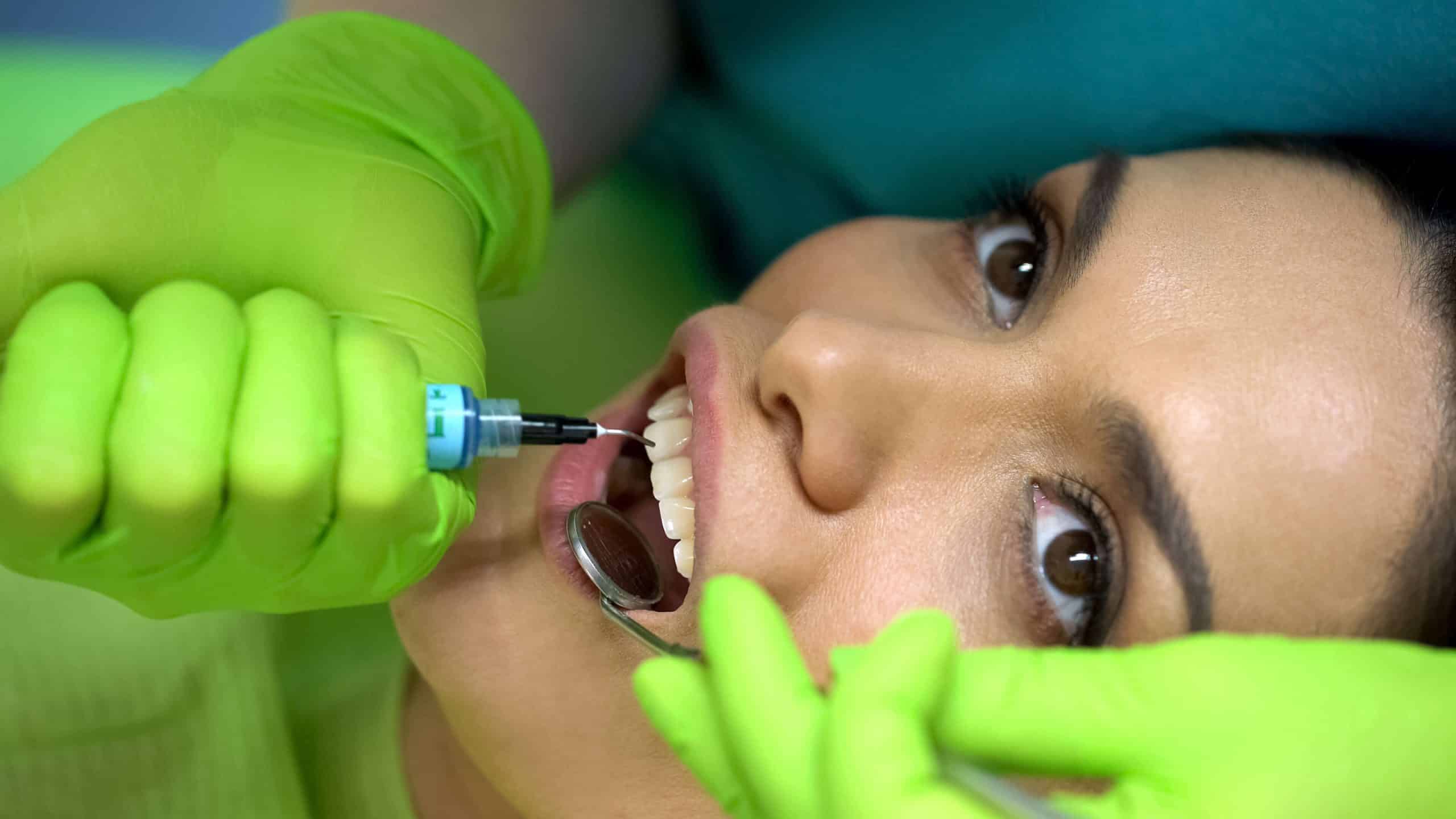 resina nos dentes