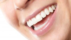 lente nos dentes