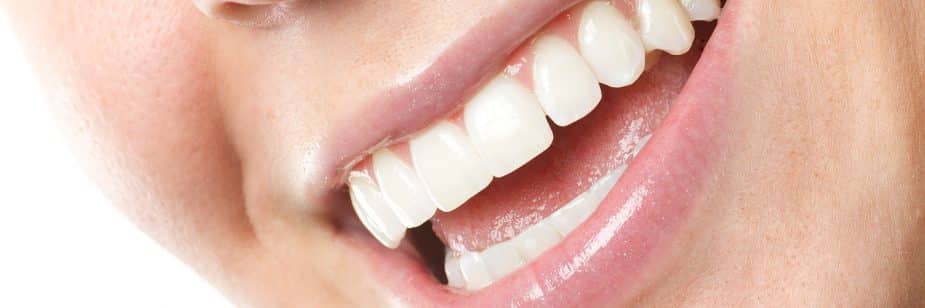 lente nos dentes