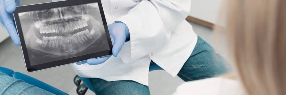 radiografia dos dentes