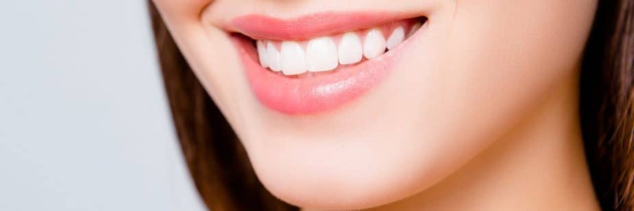 sorriso branco