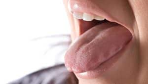 sialoreria